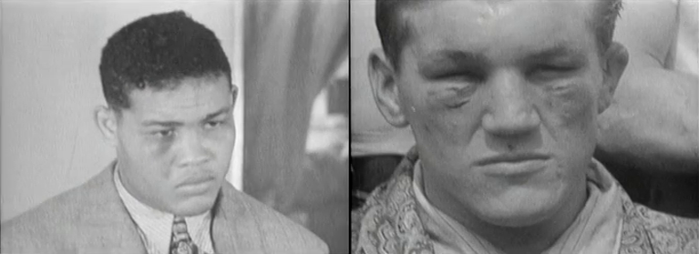 A splitscreen comparison of Louis and Farr from a post-fight video. Louis has some swelling under his right eye, both of Farr's eyes are swollen badly and he's got cut under each eye, he's also got a gnarly cauliflower ear.